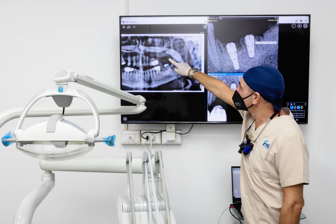 Il dottore mostra una radiografia su un grande schermo in sala di cura
